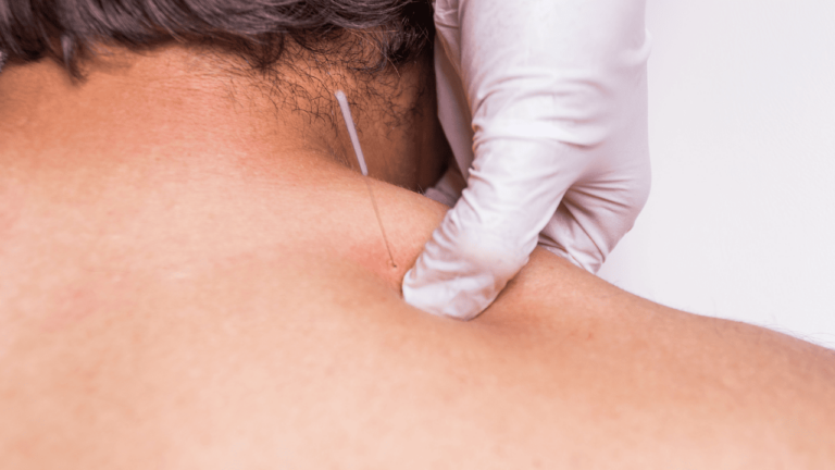 dry needling near me